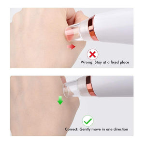 Beauty Blackhead Remover Vacuum Pore Cleaner